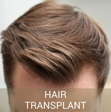https://www.clinicafera.com/wp-content/uploads/2023/06/hair-transplant.webp