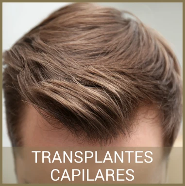 Transplantes Capilares